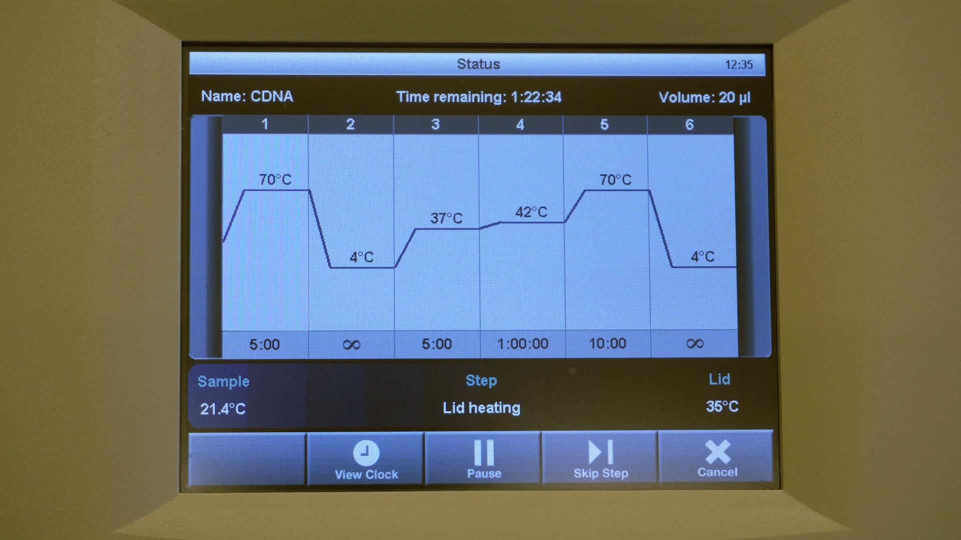 cDNA synthesis labprep.video